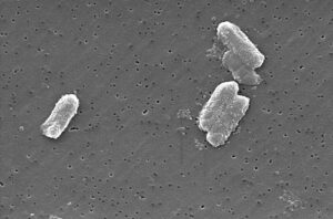 Microscopía electrónica del Citrobacter freundii. PArte del microbioma intestinal.