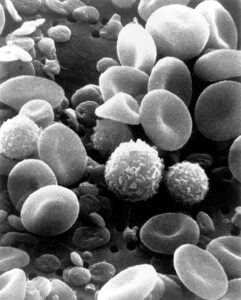 Una imagen de un microscopio electrónico de barrido de la sangre humana en circulación normal. Los glóbulos blancos aparecen como elementos redondos de superficie irregular. 